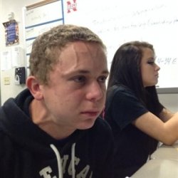 Vein forehead guy Meme Template
